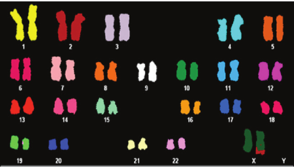 Cancer Karyotyping: Diagnostic Tool cover
