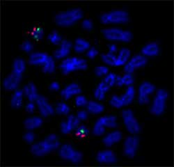 Cancer FISH: Diagnostic Tool cover